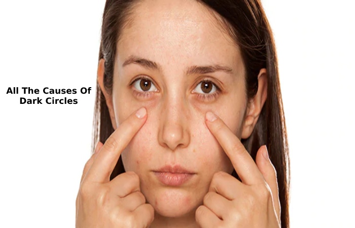 All The Causes Of Dark Circles
