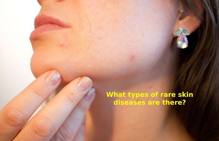 How Is A Skin Disease Diagnosed_