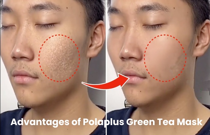 Advantages of Polaplus Green Tea Mask