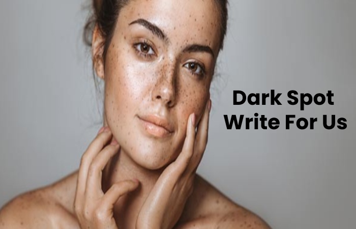 Dark Spot Write for us