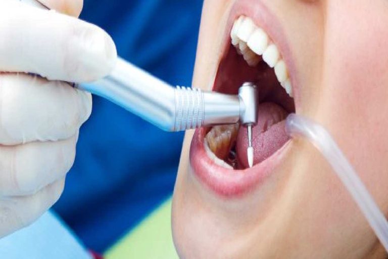 All About Dental Health And Root Canal